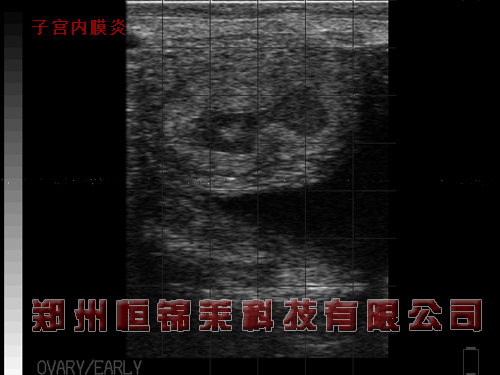高清牛用B超机检测母牛子宫炎症图片