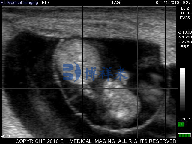 进口牛用B超检测母牛妊娠45天B超图像