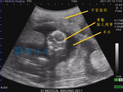 来看看母羊怀孕63天的B超影像图特点