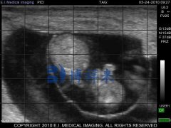 进口兽用B超检测母牛怀孕54天的B超图像特点