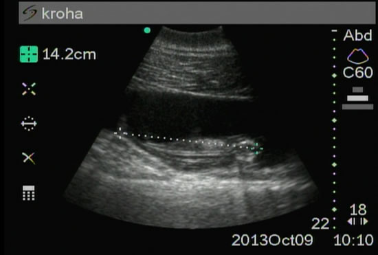 海豚怀孕3个月的超声图像